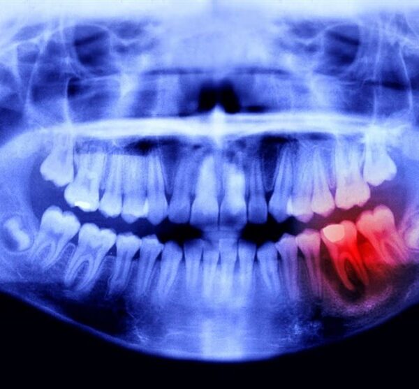 Revolutionary Tooth-Regrowing Drug Enters Human Trials: A Breakthrough in Dental Science!