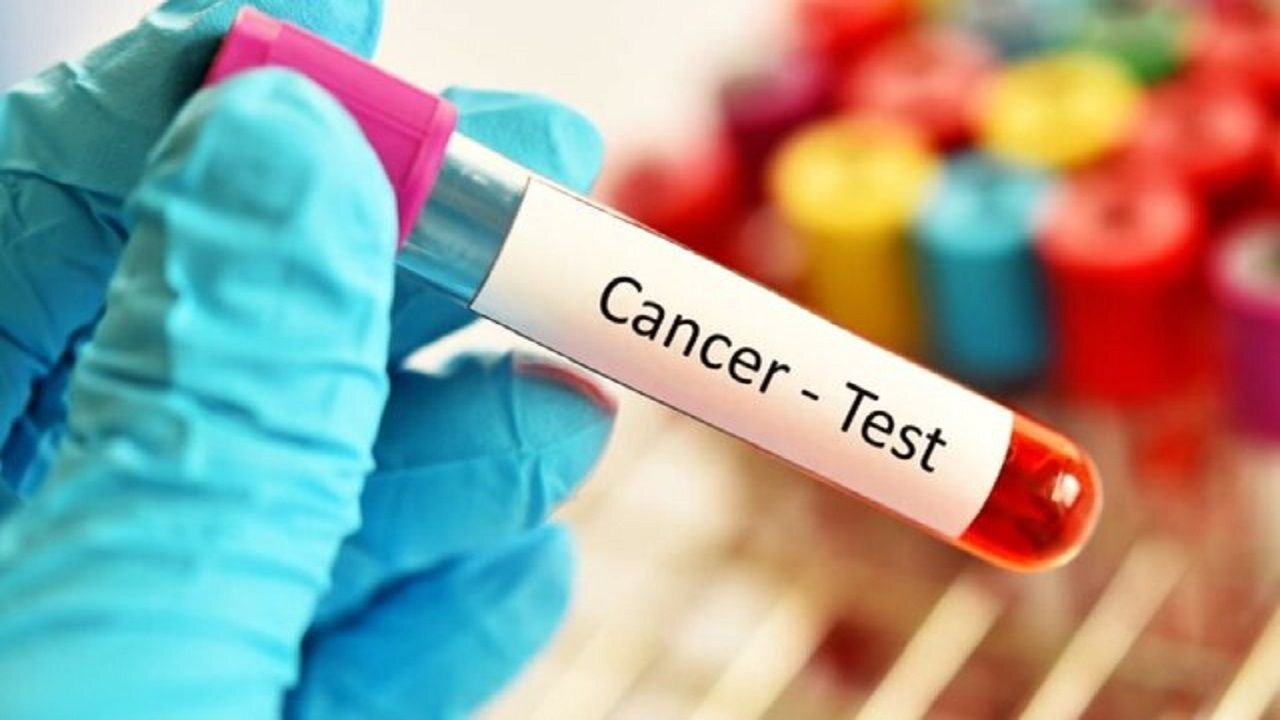 Health Ministry Launches Comprehensive Cancer Screening Initiative to Boost Early Detection