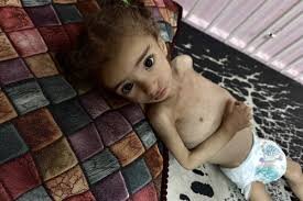 UN Sounds Alarm: 14,000 Babies in Gaza at Risk of Death in Days