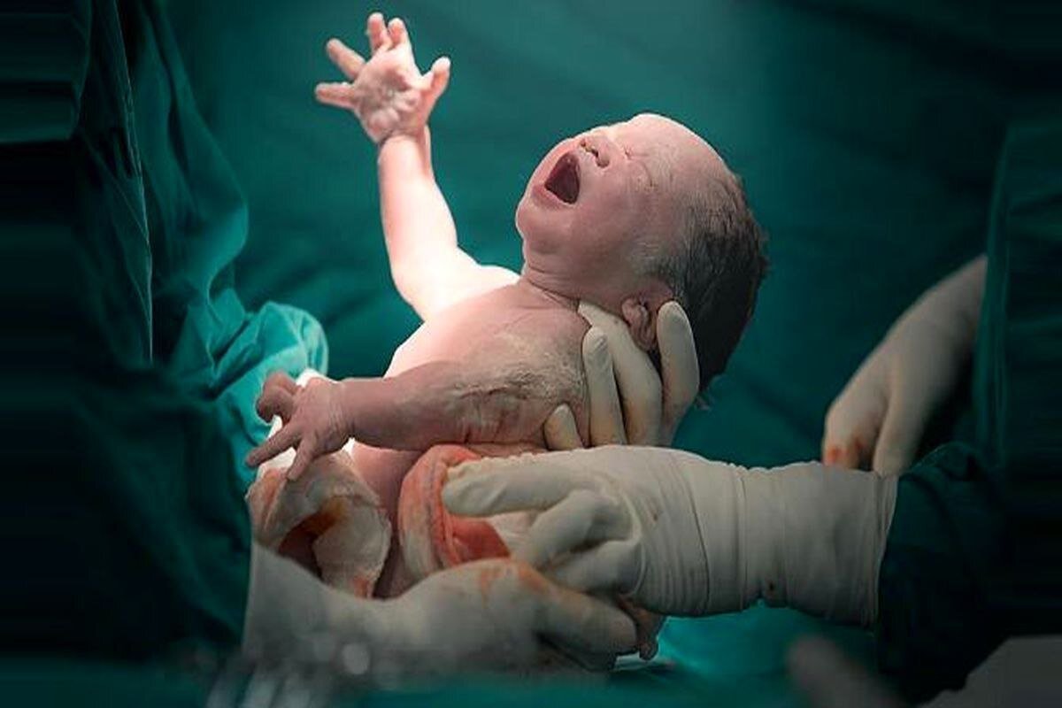UNFPA Applauds Iran's Remarkable Progress in Slashing Maternal Mortality Rates